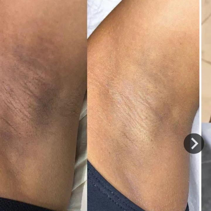 Gel exfoliant orange PEAUX MORTES ET TACHE NOIR ELIMINé 2 acheter 1 offert et une air pod offert