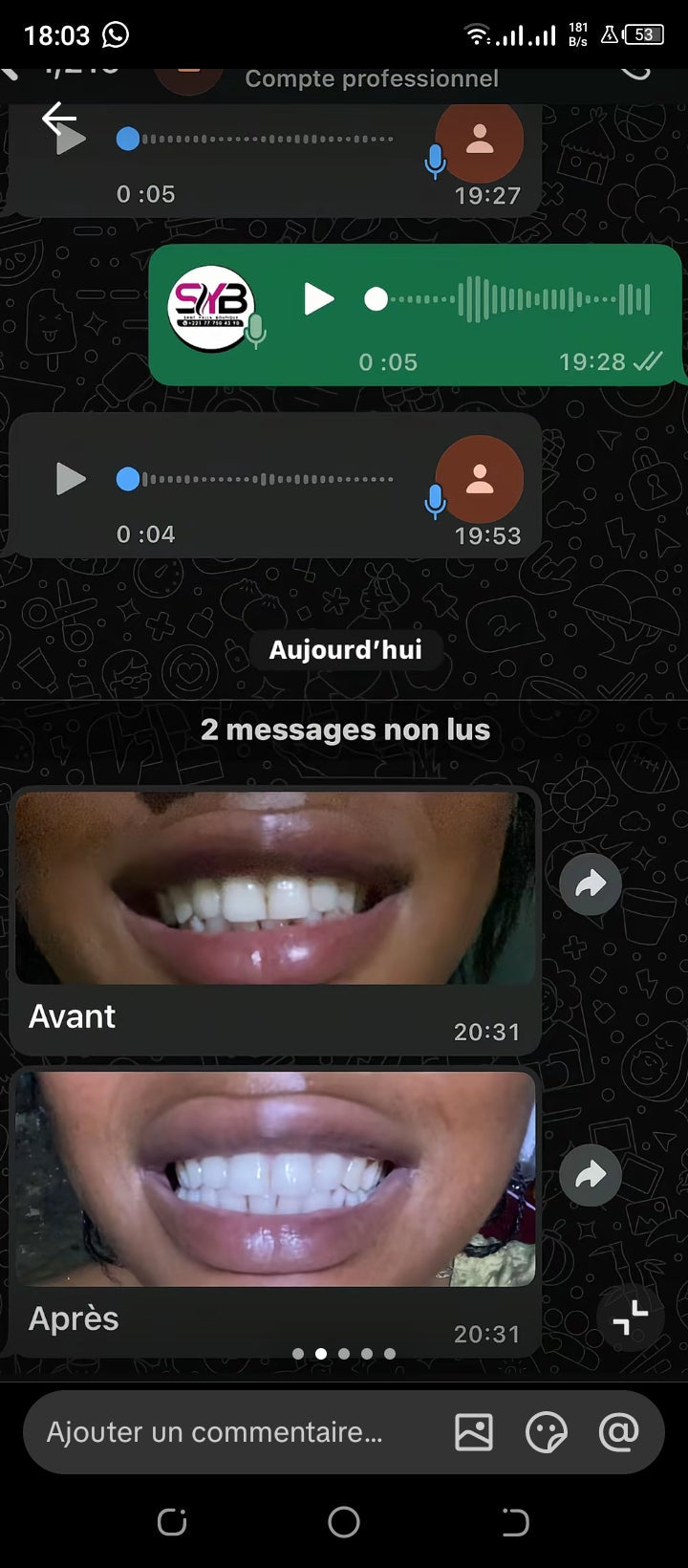 Glory smile Correcteur de Couleur V34 – Le Secret d'un Sourire Éclatant