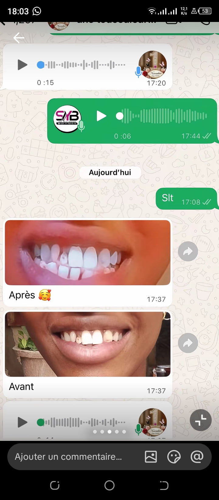 Glory smile Correcteur de Couleur V34 – Le Secret d'un Sourire Éclatant